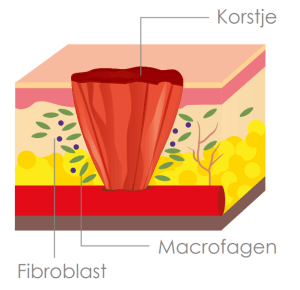 Inflammatie fase van het wondgenezingsproces