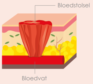 Hemostase fase van het wondgenezingsproces